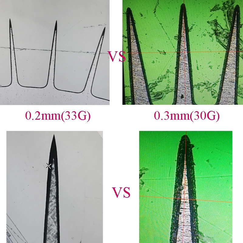 MS540 New Generation Finer Dermaroller with 33G Needles